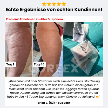 COREEX CelluFlex™ 3D-Kompressionsleggings