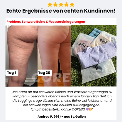 COREEX CelluFlex™ 3D-Kompressionsleggings